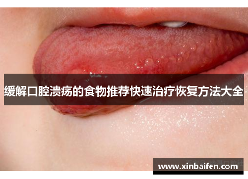 缓解口腔溃疡的食物推荐快速治疗恢复方法大全